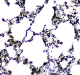 Carboxylesterase 1 / CES1 Antibody - IHC analysis of CES1 using anti-CES1 antibody. CES1 was detected in paraffin-embedded section of rat lung tissues. Heat mediated antigen retrieval was performed in citrate buffer (pH6, epitope retrieval solution) for 20 mins. The tissue section was blocked with 10% goat serum. The tissue section was then incubated with 1µg/ml rabbit anti-CES1 Antibody overnight at 4°C. Biotinylated goat anti-rabbit IgG was used as secondary antibody and incubated for 30 minutes at 37°C. The tissue section was developed using Strepavidin-Biotin-Complex (SABC) with DAB as the chromogen.