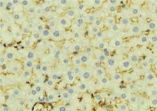 Carboxylesterase 1 / CES1 Antibody - 1:100 staining mouse liver tissue by IHC-P. The sample was formaldehyde fixed and a heat mediated antigen retrieval step in citrate buffer was performed. The sample was then blocked and incubated with the antibody for 1.5 hours at 22°C. An HRP conjugated goat anti-rabbit antibody was used as the secondary.