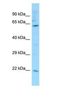 Carboxylesterase 3 / CES3 Antibody - Carboxylesterase 3 / CES3 antibody Western Blot of THP-1.  This image was taken for the unconjugated form of this product. Other forms have not been tested.