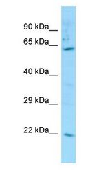 Carboxylesterase 3 / CES3 Antibody - Carboxylesterase 3 / CES3 antibody Western Blot of THP-1.  This image was taken for the unconjugated form of this product. Other forms have not been tested.