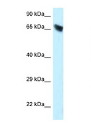 Carboxylesterase 3 / CES3 Antibody - CES3 antibody Western blot of HepG2 Cell lysate. Antibody concentration 1 ug/ml.  This image was taken for the unconjugated form of this product. Other forms have not been tested.