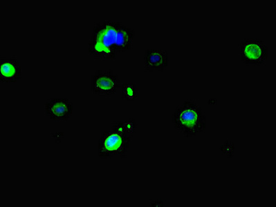 Carboxylesterase 3 / CES3 Antibody - Immunofluorescent analysis of HeLa cells diluted at 1:100 and Alexa Fluor 488-congugated AffiniPure Goat Anti-Rabbit IgG(H+L)