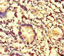 Carboxylesterase 3 / CES3 Antibody - Immunohistochemistry of paraffin-embedded human appendix tissue at dilution of 1:100