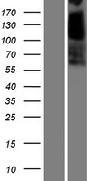 Carboxylesterase 3 / CES3 Protein - Western validation with an anti-DDK antibody * L: Control HEK293 lysate R: Over-expression lysate