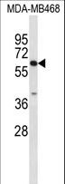 Carboxylesterase 5A / CES5A Antibody - Western blot of CES7 Antibody in MDA-MB468 cell line lysates (35 ug/lane). CES7 (arrow) was detected using the purified antibody.
