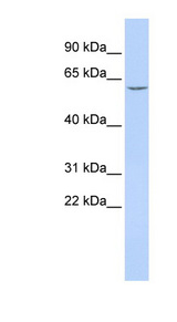 Carboxylesterase 5A / CES5A Antibody - CES5A / CES7 antibody Western blot of HepG2 cell lysate. This image was taken for the unconjugated form of this product. Other forms have not been tested.