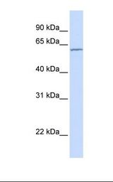 Carboxylesterase 5A / CES5A Antibody - HepG2 cell lysate. Antibody concentration: 1.0 ug/ml. Gel concentration: 12%.  This image was taken for the unconjugated form of this product. Other forms have not been tested.