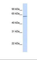 Carboxylesterase 5A / CES5A Antibody - HepG2 cell lysate. Antibody concentration: 1.0 ug/ml. Gel concentration: 12%.  This image was taken for the unconjugated form of this product. Other forms have not been tested.