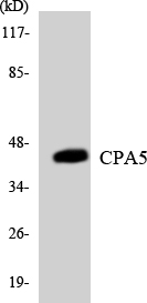 Carboxypeptidase A5 / CPA5 Antibody - Western blot analysis of the lysates from COLO205 cells using CPA5 antibody.