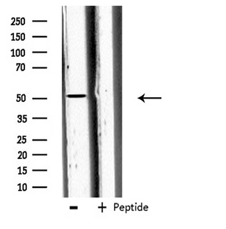 Carboxypeptidase A5 / CPA5 Antibody - Western blot analysis of extracts of 293 cells using CPA5 antibody.