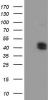 Carboxypeptidase O / CPO Antibody - HEK293T cells were transfected with the pCMV6-ENTRY control (Left lane) or pCMV6-ENTRY CPO (Right lane) cDNA for 48 hrs and lysed. Equivalent amounts of cell lysates (5 ug per lane) were separated by SDS-PAGE and immunoblotted with anti-CPO.