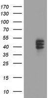 Carboxypeptidase O / CPO Antibody - HEK293T cells were transfected with the pCMV6-ENTRY control (Left lane) or pCMV6-ENTRY CPO (Right lane) cDNA for 48 hrs and lysed. Equivalent amounts of cell lysates (5 ug per lane) were separated by SDS-PAGE and immunoblotted with anti-CPO.