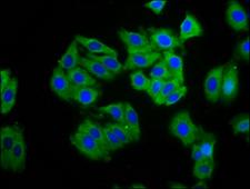 Carboxypeptidase O / CPO Antibody - Immunofluorescence staining of HepG2 cells diluted at 1:100, counter-stained with DAPI. The cells were fixed in 4% formaldehyde, permeabilized using 0.2% Triton X-100 and blocked in 10% normal Goat Serum. The cells were then incubated with the antibody overnight at 4°C.The Secondary antibody was Alexa Fluor 488-congugated AffiniPure Goat Anti-Rabbit IgG (H+L).