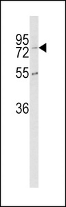 Carboxypeptidase Z / CPZ Antibody - Western blot of CPZ Antibody in K562 cell line lysates (35 ug/lane). CPZ (arrow) was detected using the purified antibody.