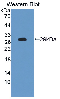 Carboxypeptidase Z / CPZ Antibody - Western blot of Carboxypeptidase Z / CPZ antibody.