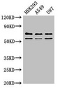 Carboxypeptidase Z / CPZ Antibody - Western Blot Positive WB detected in: HEK293 whole cell lysate, A549 whole cell lysate, U87 whole cell lysate All lanes: CPZ antibody at 3µg/ml Secondary Goat polyclonal to rabbit IgG at 1/50000 dilution Predicted band size: 74, 73, 59 kDa Observed band size: 74, 59 kDa