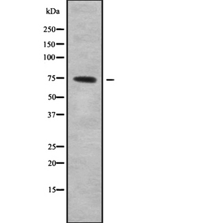 Carboxypeptidase Z / CPZ Antibody - Western blot analysis of CPZ using HepG2 whole cells lysates