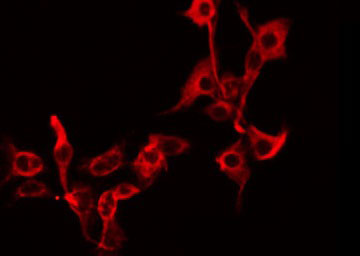 Carboxypeptidase Z / CPZ Antibody - Staining A549 cells by IF/ICC. The samples were fixed with PFA and permeabilized in 0.1% Triton X-100, then blocked in 10% serum for 45 min at 25°C. The primary antibody was diluted at 1:200 and incubated with the sample for 1 hour at 37°C. An Alexa Fluor 594 conjugated goat anti-rabbit IgG (H+L) Ab, diluted at 1/600, was used as the secondary antibody.