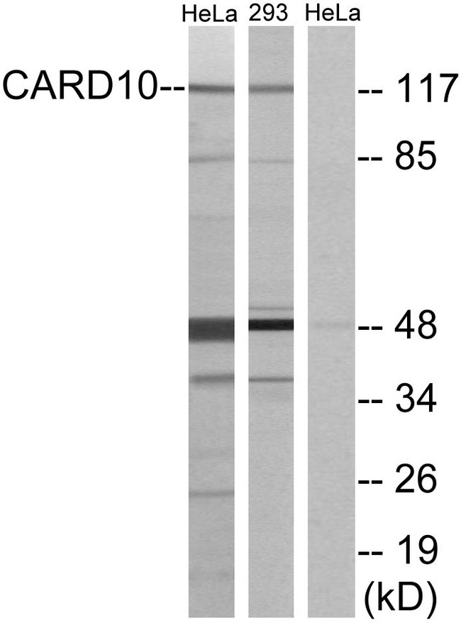 CARD10 / CARMA3 Antibody - Western blot analysis of lysates from HeLa and 293 cells, using CARD10 Antibody. The lane on the right is blocked with the synthesized peptide.