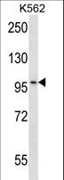 CARD10 / CARMA3 Antibody - CARD10 Antibody western blot of K562 cell line lysates (35 ug/lane). The CARD10 antibody detected the CARD10 protein (arrow).