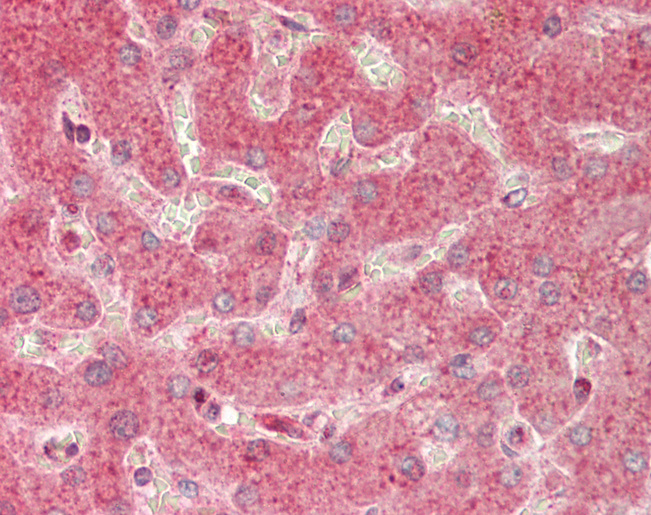 CARD10 / CARMA3 Antibody - Human Liver: Formalin-Fixed, Paraffin-Embedded (FFPE).  This image was taken for the unconjugated form of this product. Other forms have not been tested.