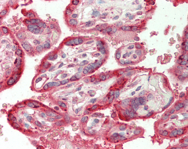 CARD10 / CARMA3 Antibody - Human Placenta: Formalin-Fixed, Paraffin-Embedded (FFPE).  This image was taken for the unconjugated form of this product. Other forms have not been tested.