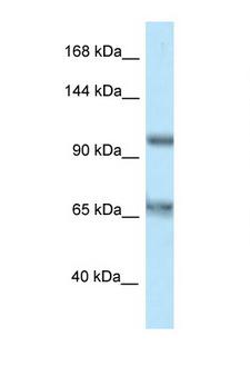CARD10 / CARMA3 Antibody - CARD10 antibody Western blot of HT1080 Cell lysate. Antibody concentration 1 ug/ml.  This image was taken for the unconjugated form of this product. Other forms have not been tested.