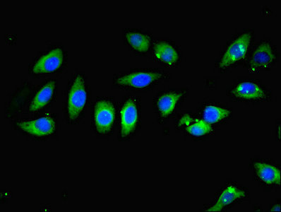 CARD10 / CARMA3 Antibody - Immunofluorescent analysis of A549 cells using CARD10 Antibody at dilution of 1:100 and Alexa Fluor 488-congugated AffiniPure Goat Anti-Rabbit IgG(H+L)