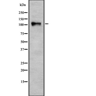 CARD10 / CARMA3 Antibody - Western blot analysis of CARD10 using HeLa whole cells lysates