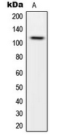 CARD14 Antibody - Western blot analysis of CARD14 expression in HeLa (A) whole cell lysates.