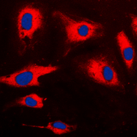 CARD14 Antibody - Immunofluorescent analysis of CARD14 staining in HeLa cells. Formalin-fixed cells were permeabilized with 0.1% Triton X-100 in TBS for 5-10 minutes and blocked with 3% BSA-PBS for 30 minutes at room temperature. Cells were probed with the primary antibody in 3% BSA-PBS and incubated overnight at 4 C in a humidified chamber. Cells were washed with PBST and incubated with a DyLight 594-conjugated secondary antibody (red) in PBS at room temperature in the dark. DAPI was used to stain the cell nuclei (blue).