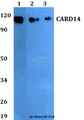 CARD14 Antibody - Western blot of CARD14 antibody at 1:500 dilution. Lane 1: A549 whole cell lysate. Lane 2: sp2/0 whole cell lysate. Lane 3: PC12 whole cell lysate.