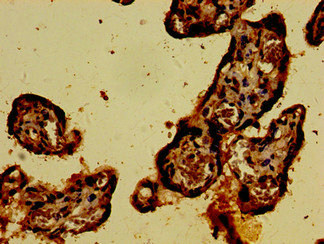 CARD14 Antibody - Immunohistochemistry image of paraffin-embedded human placenta tissue at a dilution of 1:100