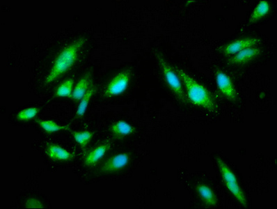 CARD14 Antibody - Immunofluorescence staining of Hela cells with CARD14 Antibody at 1:100, counter-stained with DAPI. The cells were fixed in 4% formaldehyde, permeabilized using 0.2% Triton X-100 and blocked in 10% normal Goat Serum. The cells were then incubated with the antibody overnight at 4°C. The secondary antibody was Alexa Fluor 488-congugated AffiniPure Goat Anti-Rabbit IgG(H+L).