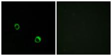 CARD14 Antibody - Peptide - + Immunofluorescence analysis of MCF-7 cells, using CAR14 antibody.
