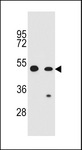 CARD16 / COP Antibody - COP1 Antibody western blot of CEM,A549 cell line lysates (35 ug/lane). The COP1 antibody detected the COP1 protein (arrow).