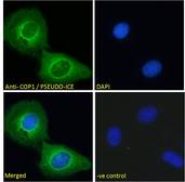 CARD16 / COP Antibody - CARD16 / COP antibody immunofluorescence analysis of paraformaldehyde fixed U2OS cells, permeabilized with 0.15% Triton. Primary incubation 1hr (10ug/ml) followed by Alexa Fluor 488 secondary antibody (2ug/ml), showing mitochondrial staining. The nuclear stain is DAPI (blue). Negative control: Unimmunized goat IgG (10ug/ml) followed by Alexa Fluor 488 secondary antibody (2ug/ml).