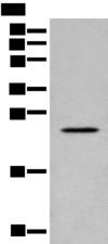 CARD16 / COP Antibody - Western blot analysis of Human placenta tissue lysate  using CARD16 Polyclonal Antibody at dilution of 1:800