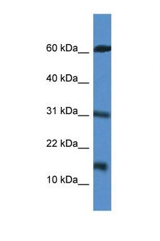 CARD17 / INCA Antibody - CARD17 antibody Western blot of Jurkat Cell lysate. Antibody concentration 1 ug/ml.  This image was taken for the unconjugated form of this product. Other forms have not been tested.