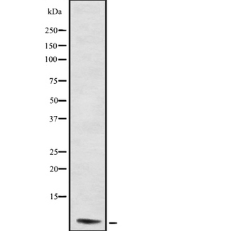 CARD18 / ICEBERG Antibody - Western blot analysis ICBR using LOVO cells whole cells lysates