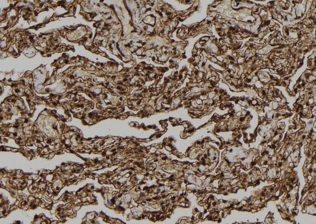 CARD18 / ICEBERG Antibody - 1:100 staining human lung tissue by IHC-P. The sample was formaldehyde fixed and a heat mediated antigen retrieval step in citrate buffer was performed. The sample was then blocked and incubated with the antibody for 1.5 hours at 22°C. An HRP conjugated goat anti-rabbit antibody was used as the secondary.