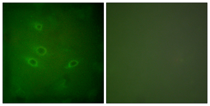 CARD6 Antibody - Immunofluorescence analysis of HeLa cells, using CARD6 Antibody. The picture on the right is blocked with the synthesized peptide.