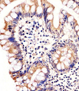 CARD6 Antibody - Immunohistochemical of paraffin-embedded H. colon section using CARD6 Antibody. Antibody was diluted at 1:25 dilution. A undiluted biotinylated goat polyvalent antibody was used as the secondary, followed by DAB staining.
