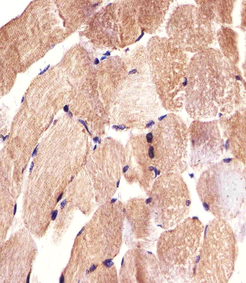 CARD6 Antibody - Immunohistochemical of paraffin-embedded H. skeletal muscle section using CARD6 Antibody. Antibody was diluted at 1:25 dilution. A undiluted biotinylated goat polyvalent antibody was used as the secondary, followed by DAB staining.
