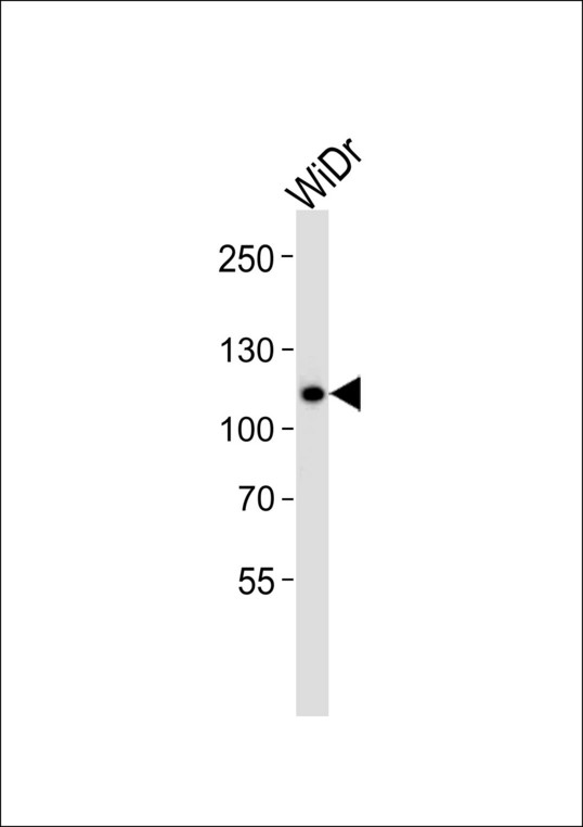 CARD6 Antibody - Western blot of lysate from WiDr cell line with CARD6 Antibody. Antibody was diluted at 1:1000. A goat anti-rabbit IgG H&L (HRP) at 1:5000 dilution was used as the secondary antibody. Lysate at 20 ug.