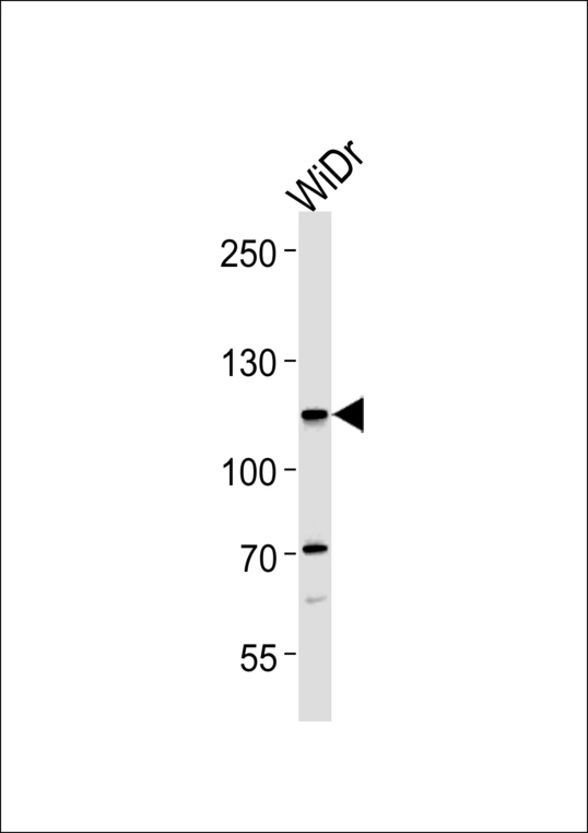 CARD6 Antibody - CARD6 Antibody western blot of WiDr cell line lysates (35 ug/lane). The CARD6 antibody detected the CARD6 protein (arrow).