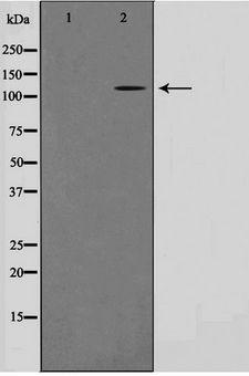 CARD6 Antibody - Western blot of HeLa cell lysate using CARD6 Antibody