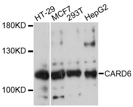 CARD6 Antibody - Western blot analysis of extracts of various cell lines, using CARD6 antibody at 1:3000 dilution. The secondary antibody used was an HRP Goat Anti-Rabbit IgG (H+L) at 1:10000 dilution. Lysates were loaded 25ug per lane and 3% nonfat dry milk in TBST was used for blocking. An ECL Kit was used for detection and the exposure time was 30s.