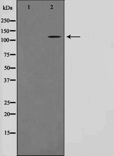 CARD6 Antibody - Western blot analysis on HeLa cell lysates using CARD6 antibody. The lane on the left is treated with the antigen-specific peptide.