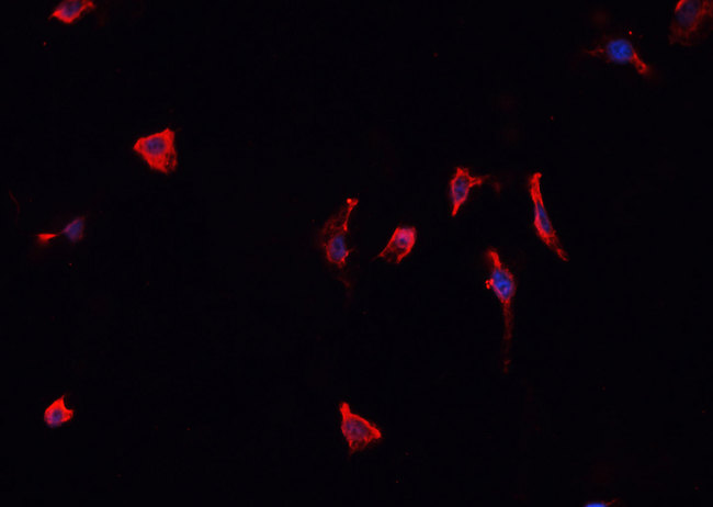 CARD6 Antibody - Staining K562 cells by IF/ICC. The samples were fixed with PFA and permeabilized in 0.1% Triton X-100, then blocked in 10% serum for 45 min at 25°C. The primary antibody was diluted at 1:200 and incubated with the sample for 1 hour at 37°C. An Alexa Fluor 594 conjugated goat anti-rabbit IgG (H+L) antibody, diluted at 1/600, was used as secondary antibody.